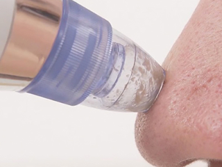 DermaSuction product photo Internal 3 DETAILS